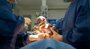 Breastfeeding after a Cesarean Birth